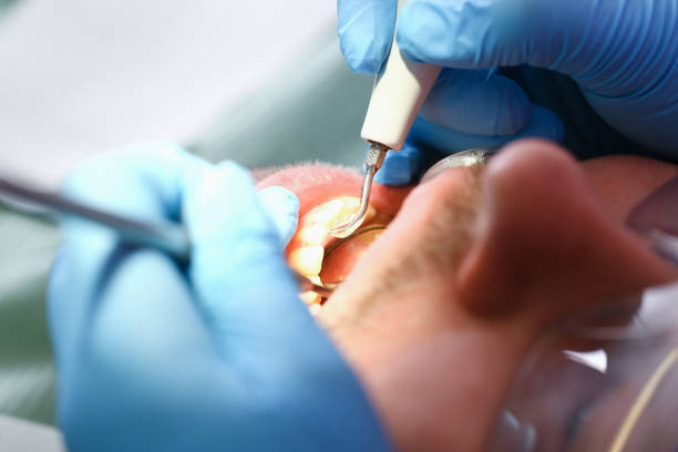 Best Emergency Dental Care for Abscessed Tooth in Batesville, TX