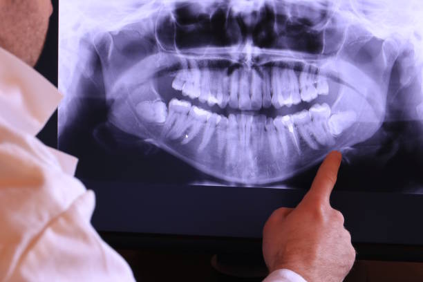 Best Broken or Cracked Tooth Emergency Dentist in Batesville, TX