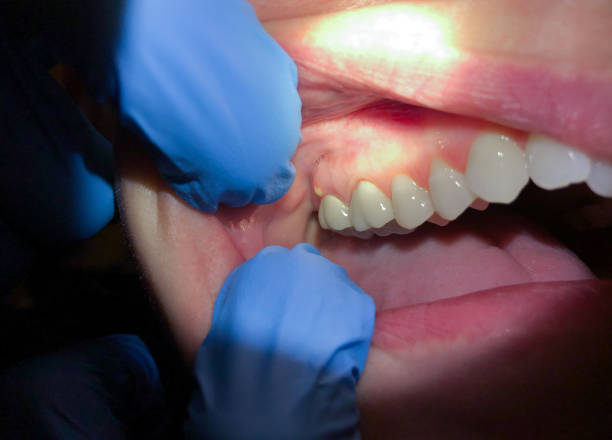 Best Orthodontic Emergency Dentist in Batesville, TX