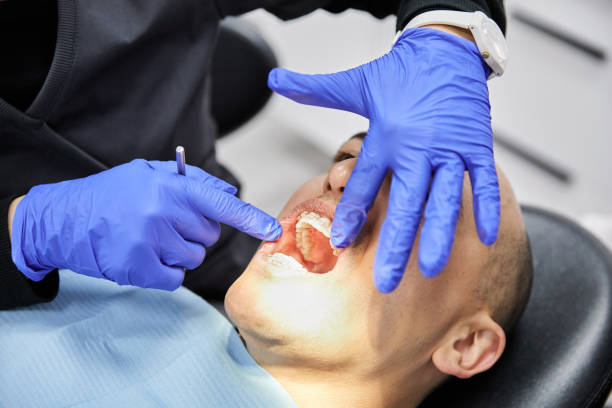 Best Emergency Dentist for Lost Fillings or Crowns in Batesville, TX